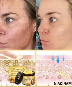 𝑫𝒂𝒂𝒔𝒓𝒚® 𝑩𝒆𝒆 𝑽𝒆𝒏𝒐𝒎 𝑺𝒌𝒊𝒏 𝑹𝒆𝒑𝒂𝒊𝒓 & 𝑨𝒏𝒕𝒊-𝑨𝒈𝒊𝒏𝒈 𝑪𝒓𝒆𝒂𝒎