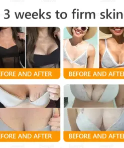 Daasry® Bee Venom Treatment Cream with bee venom peptides, botulinum toxin, hyaluronic acid, and collagen. Targets wrinkles, fine lines, sagging, stretch marks, dark spotsfirming, lifting and more