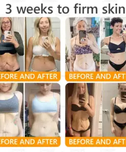 Daasry® Bee Venom Treatment Cream with bee venom peptides, botulinum toxin, hyaluronic acid, and collagen. Targets wrinkles, fine lines, sagging, stretch marks, dark spotsfirming, lifting and more