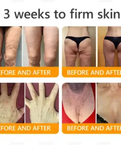 Daasry® Bee Venom Treatment Cream with bee venom peptides, botulinum toxin, hyaluronic acid, and collagen. Targets wrinkles, fine lines, sagging, stretch marks, dark spotsfirming, lifting and more