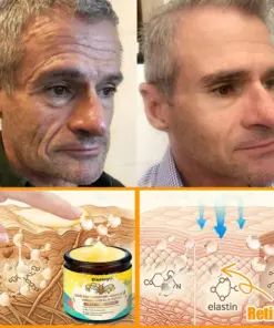 Daasry® Bee Venom Treatment Cream with bee venom peptides, botulinum toxin, hyaluronic acid, and collagen. Targets wrinkles, fine lines, sagging, stretch marks, dark spotsfirming, lifting and more