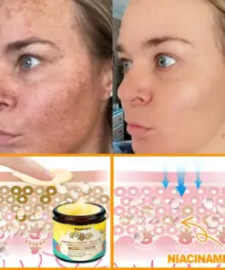 Daasry® Bee Venom Treatment Cream with bee venom peptides, botulinum toxin, hyaluronic acid, and collagen. Targets wrinkles, fine lines, sagging, stretch marks, dark spotsfirming, lifting and more